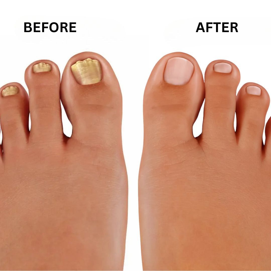 PureNail