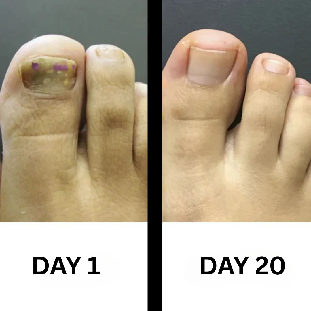PureNail