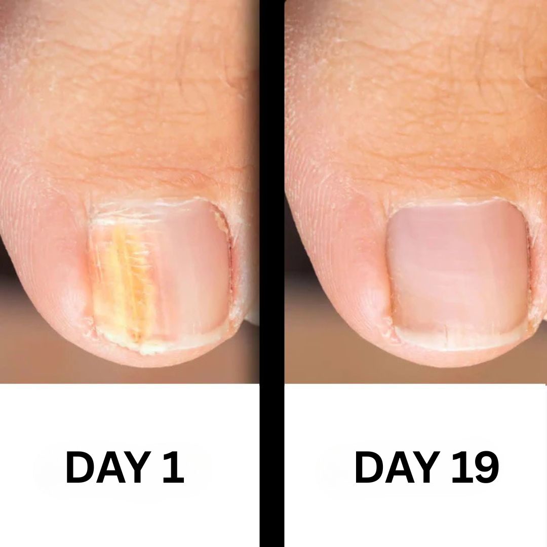 PureNail