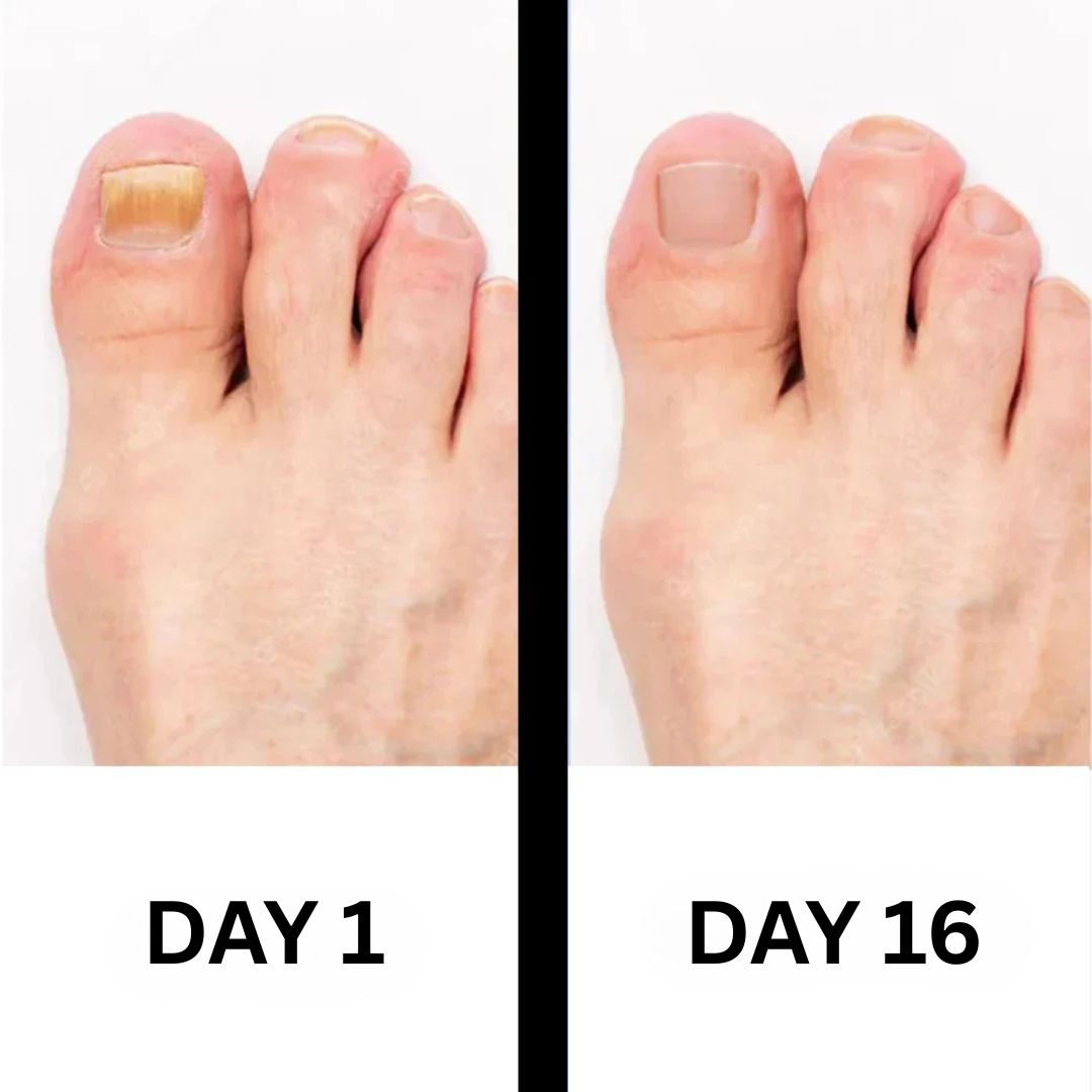 PureNail